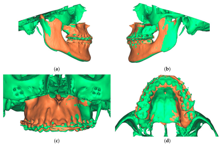 Figure 12