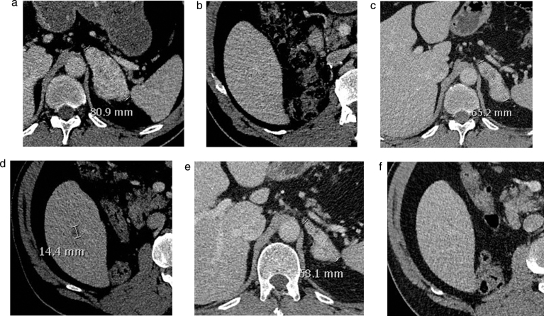 Fig.4