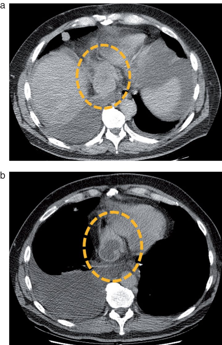 Fig.2