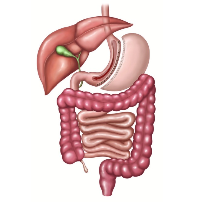 Figure 2.