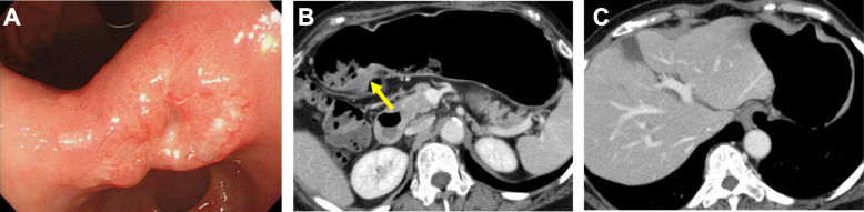 Fig. 1