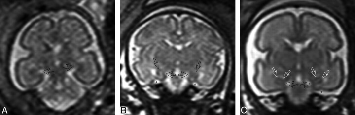 Fig 2.