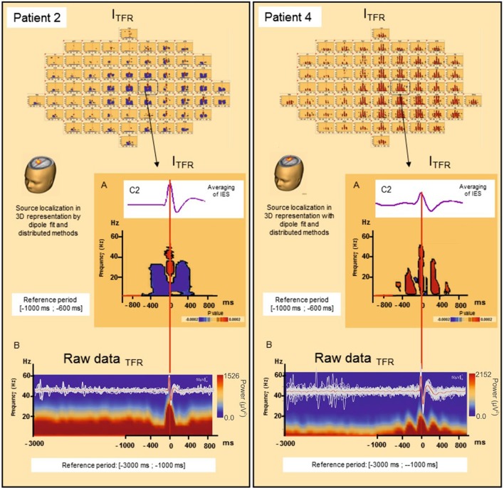 Figure 4