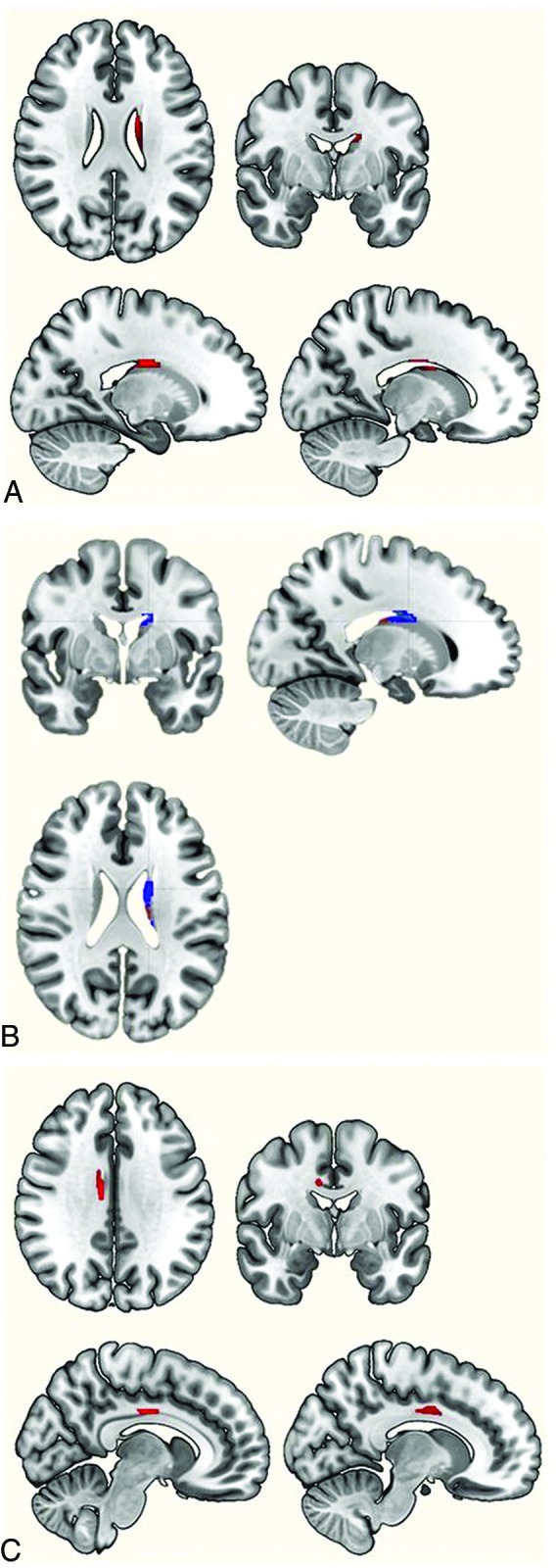 Fig 3.