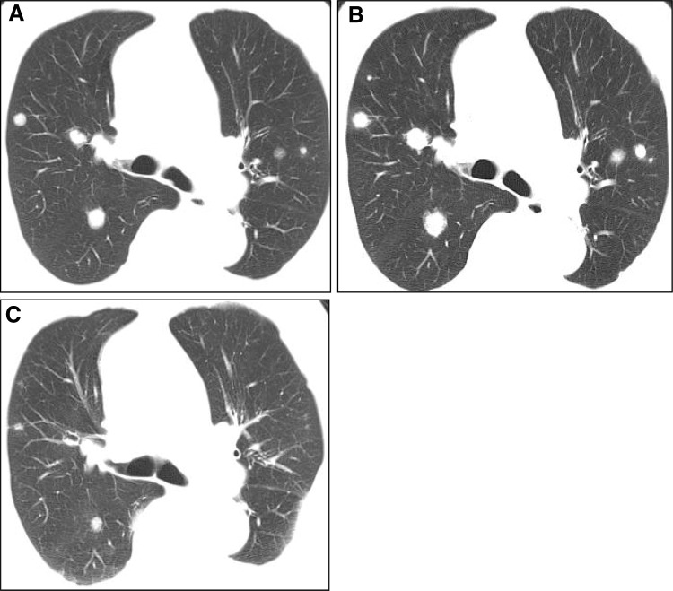 Fig. 2