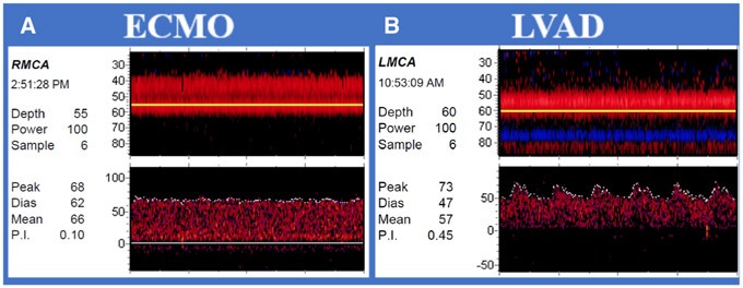 Fig 3.