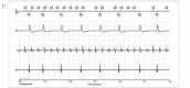 Figure 5C