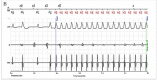 Figure 5B