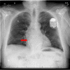 Figure 2B