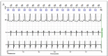 Figure 5A