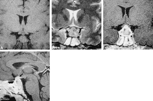 fig 1.