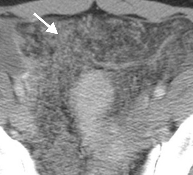 Figure 3c: