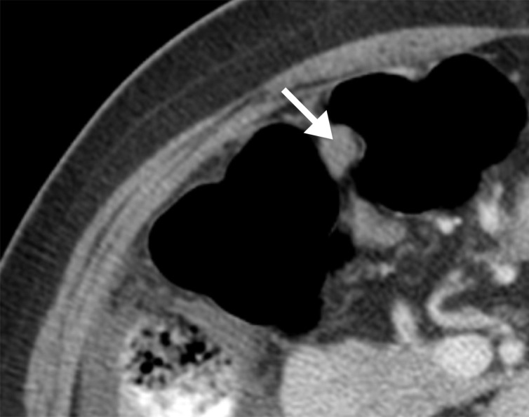 Figure 3e: