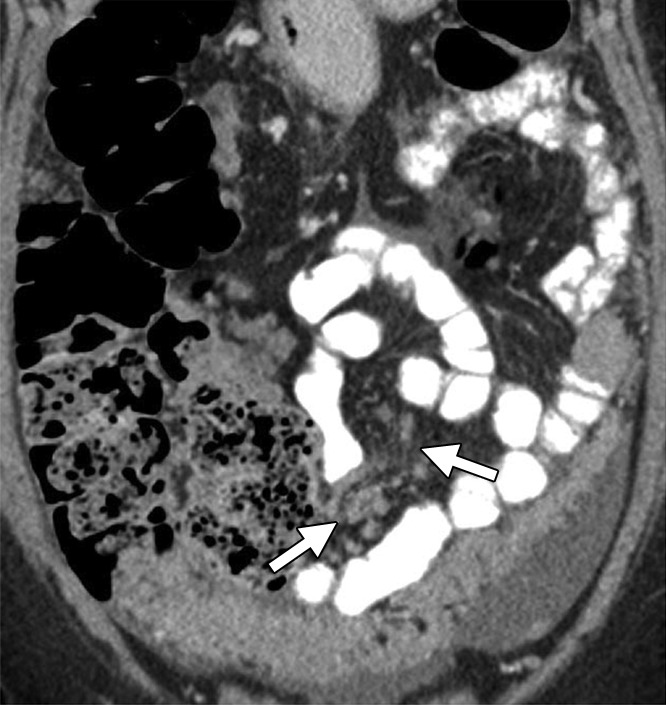 Figure 2b: