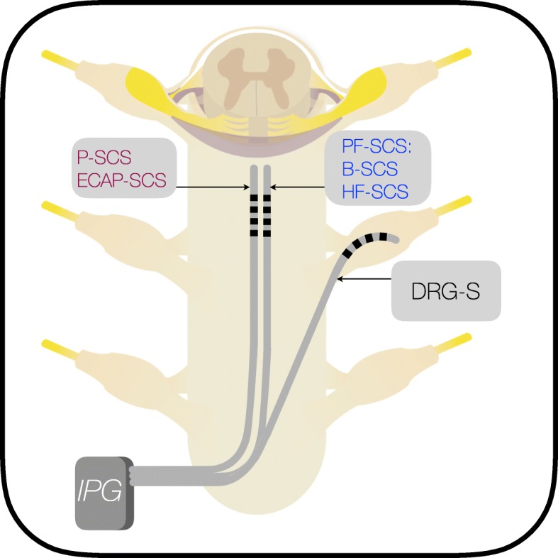 Fig. 1
