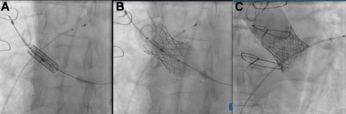 Figure 2