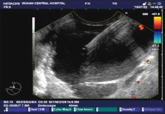 Figure 4