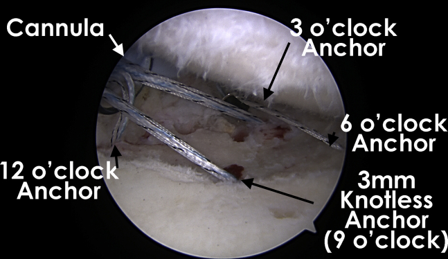 Fig 4