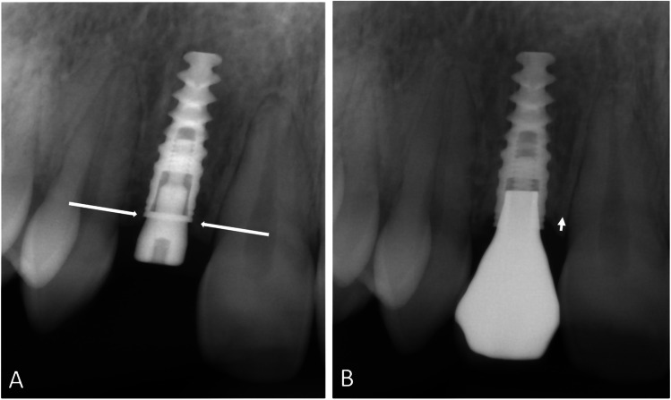 Fig. 5