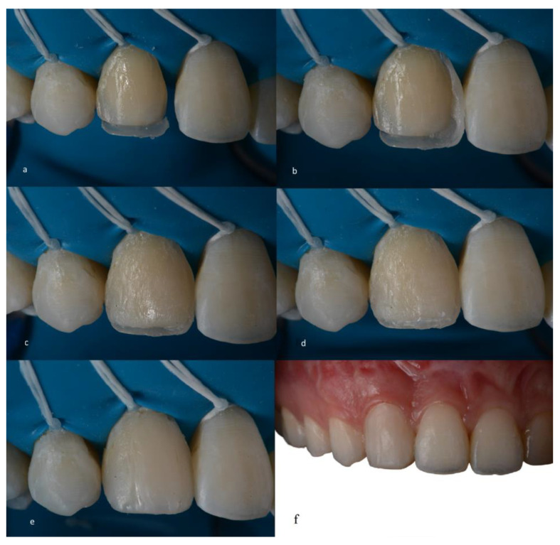 Figure 7