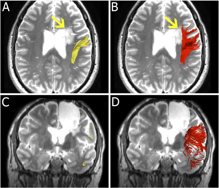 Fig. 2