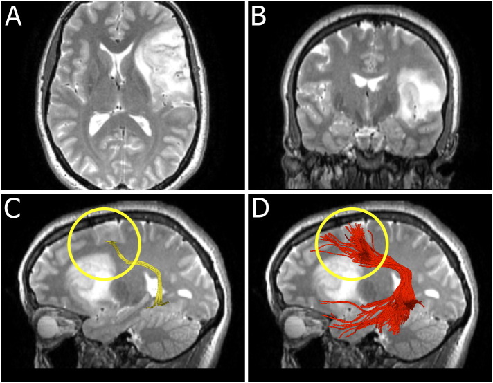 Fig. 4