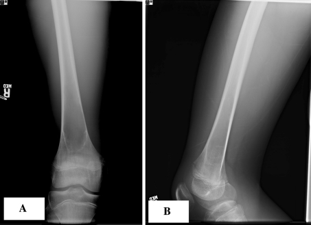 Fig. 2A–B