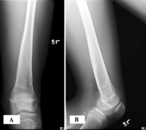 Fig. 5A–B