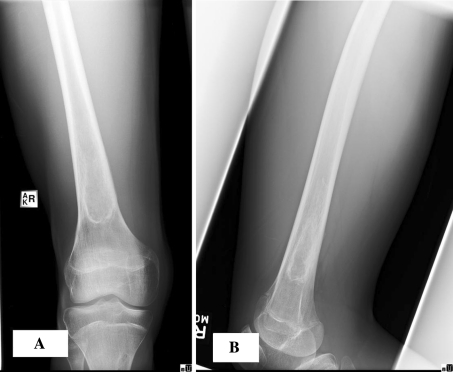 Fig. 6A–B