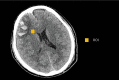 FIG. 1.