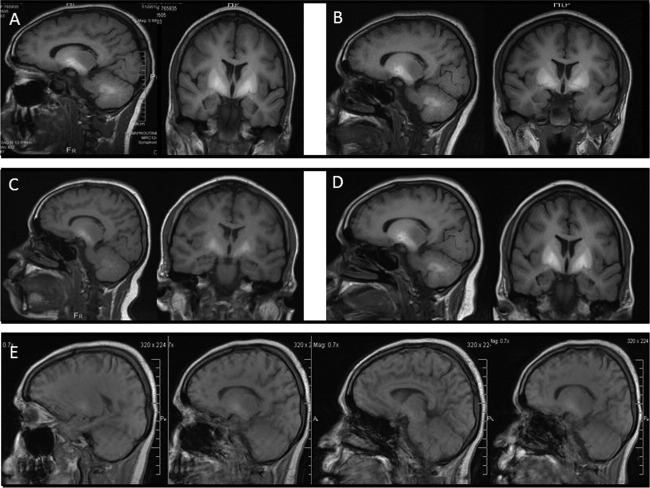 FIG. 1