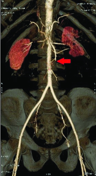 [Table/Fig-4]: