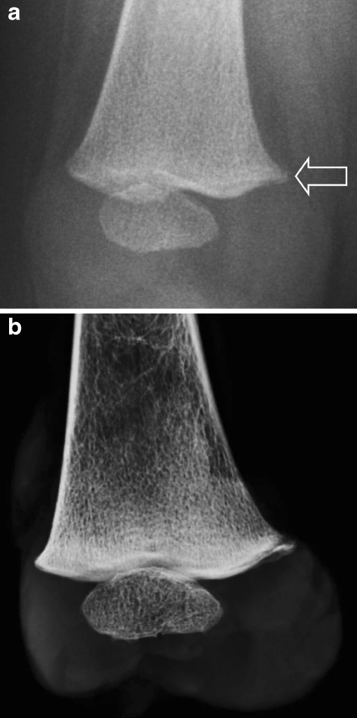 Fig. 5