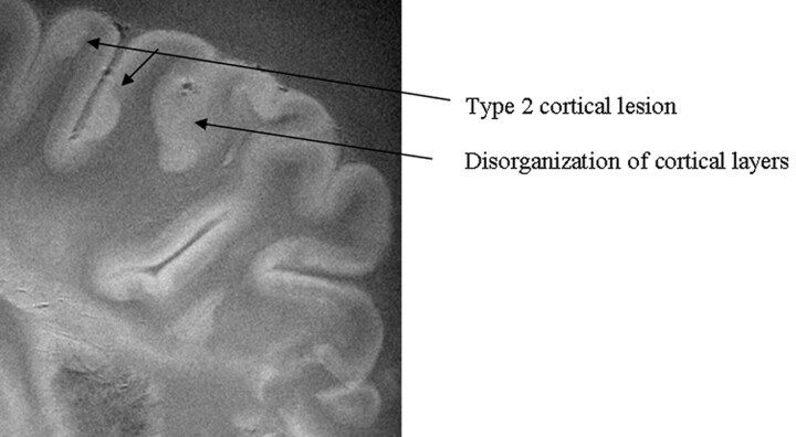 Fig 2.