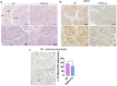 Panel A: Histological comparison of WT and P2RX5 KO tissues (white adipose tissue, skeletal muscle and brown adipose tissue), at two magnifications, stained with H&E. Panel B: Histological comparison of WT and P2RX5 KO brown adipose tissue, at two magnifications, stained with UCP1 antibody. Panel C: Histological comparison of WT and P2RX5 KO brown adipose tissue, stained with TH. Bar graph showing the number of TH positive fibres on 100 adipocytes between WT and P2RX5 KO tissues.