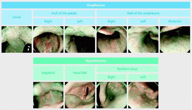 Fig. 1