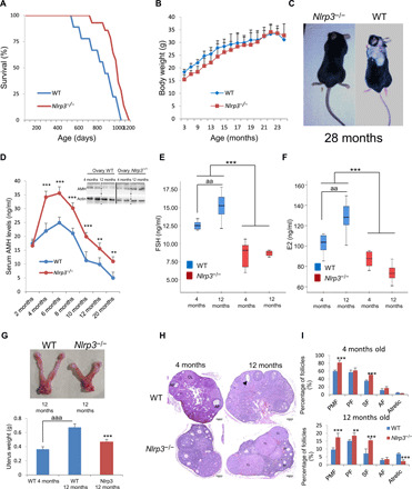 Inhibition of the NLRP3 inflammasome prevents ovarian aging - PMC