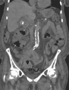 Fig 2.