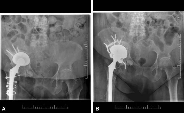 Fig. 1A–B