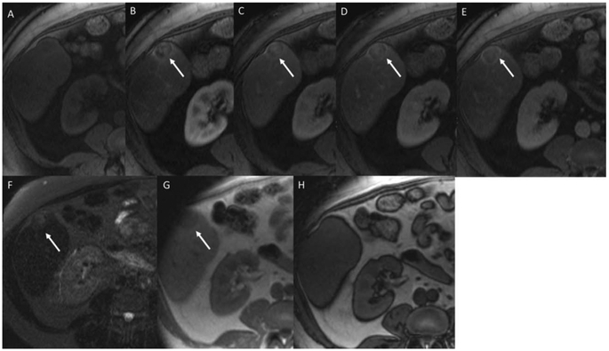 FIG. 5.