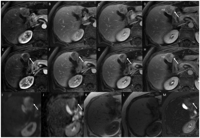 FIG. 6.