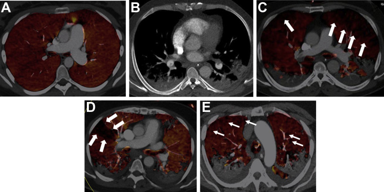 Fig. 3