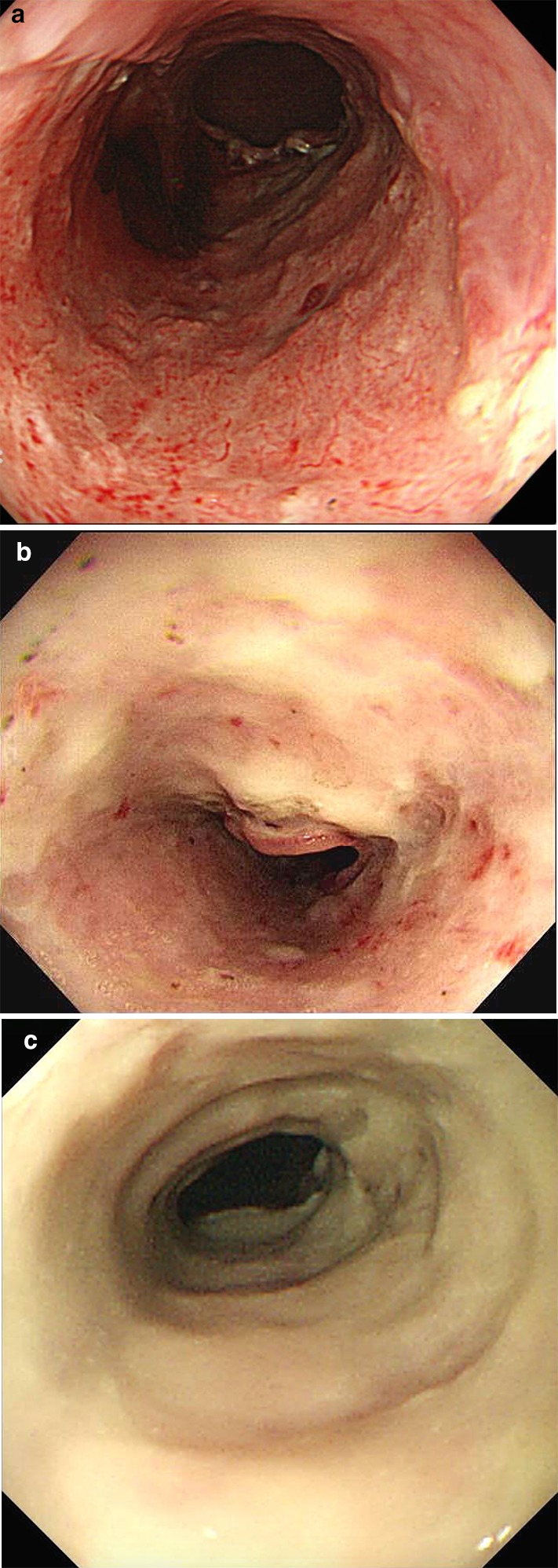 Fig. 1