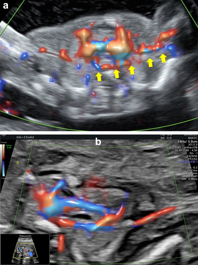Fig. 4