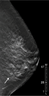 Figure 1e:
