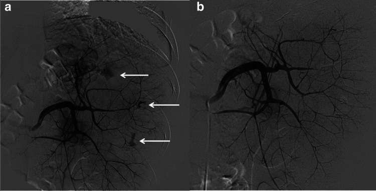 Fig. 4