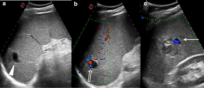 Fig. 1