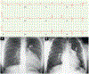 FIGURE 30