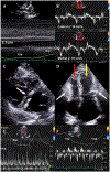 FIGURE 22