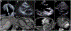 FIGURE 19